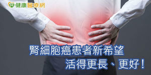 腎臟癌發生人數增3倍 免疫療法提供治療新契機